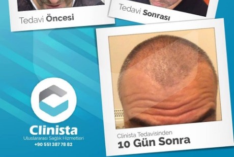 Clinista Uluslararası Sağlık Merkezi